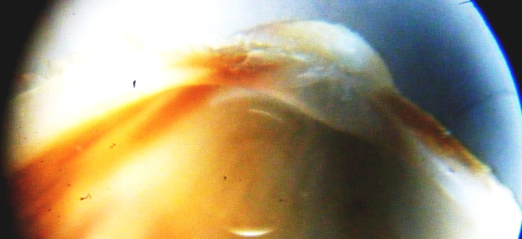 Plagiocardium papillosum